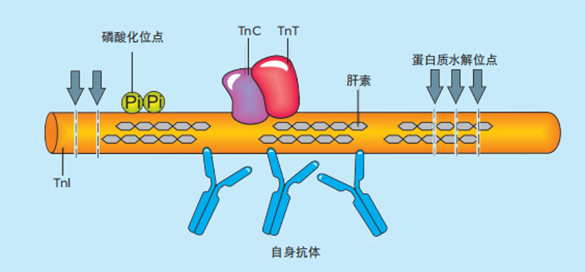心?；颊哐褐械?cTnI分子片段
